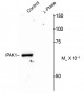 Phospho-Thr84 PAK1 Antibody